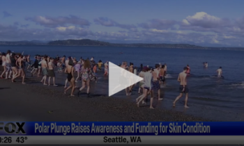 Polar Plunge Raises Awareness Of, And Funding For, Skin Condition