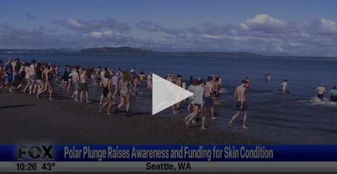 Polar Plunge Raises Awareness Of, And Funding For, Skin Condition