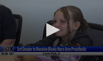 3rd Grader To Receive Bionic Hero Arm Prosthetic