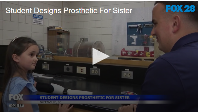 Student Designs Prosthetic For Sister May 15 2025