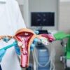 Uterine Fibroids Linked To Women’s Heart Disease Risk