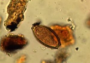 Research reveals Roman soldiers were plagued by gut parasites