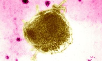 Two confirmed measles cases reported in Grant County children